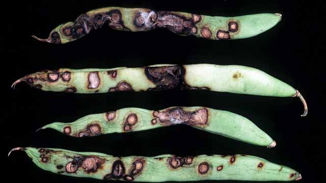 ლობიო ანთრაქრონოზი ლაკდფლკაჯს